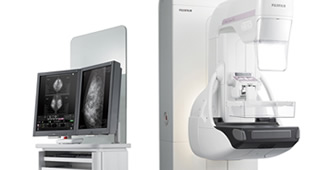 3Dマンモグラフィ